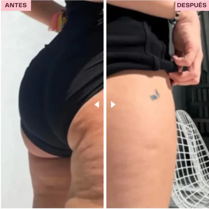 Masajeador de Ventosas Eléctrico con 9 Niveles